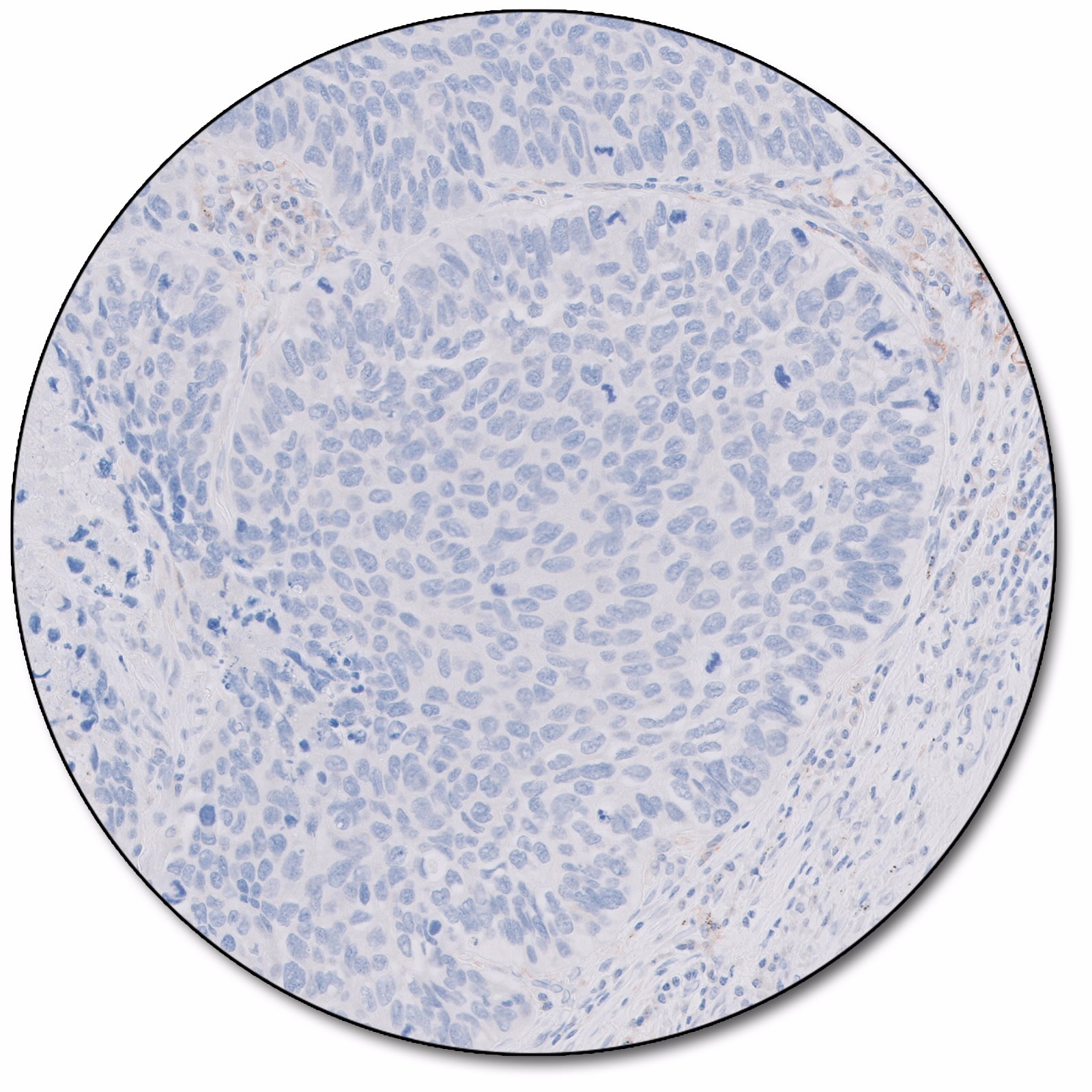 PD-L1 IHC 28-8 pharmDx for Autostainer Link 48